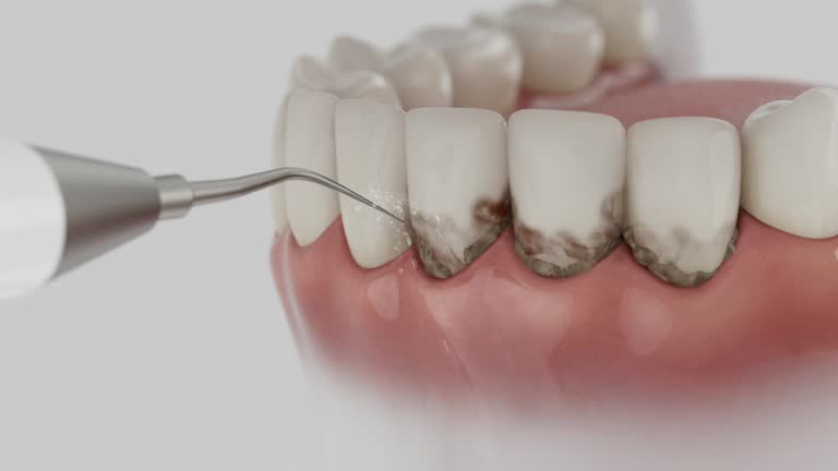 Trusted Root Canal Treatment service in Logan Elm Village, OH - Dentist Open Now